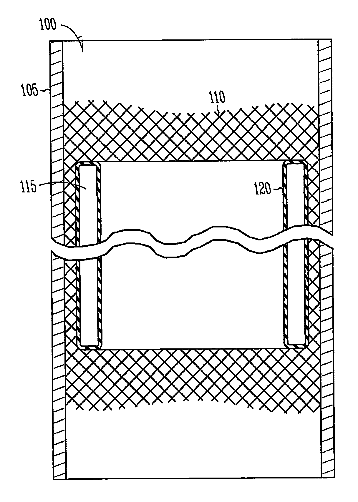 Vascular elastance