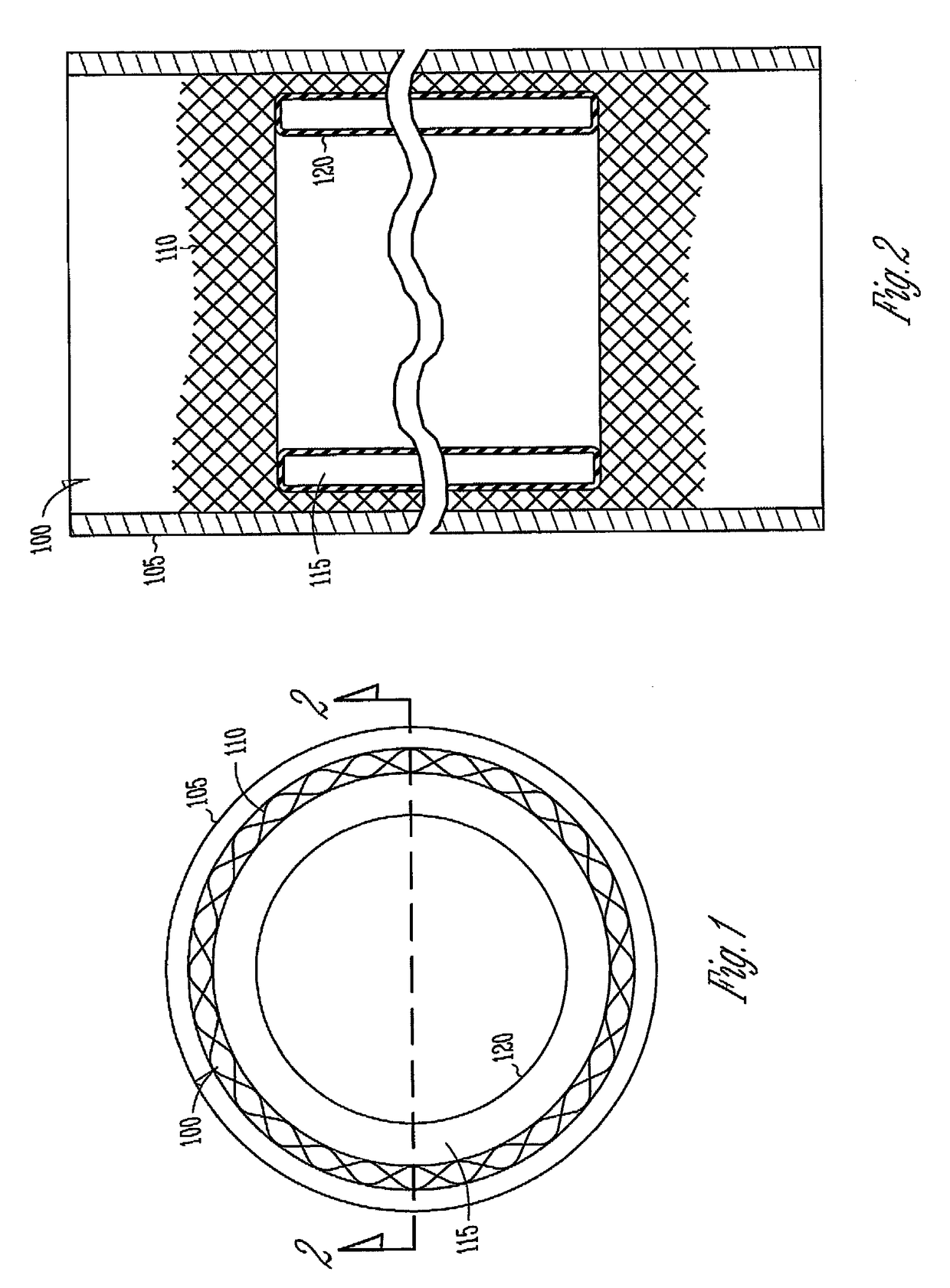 Vascular elastance