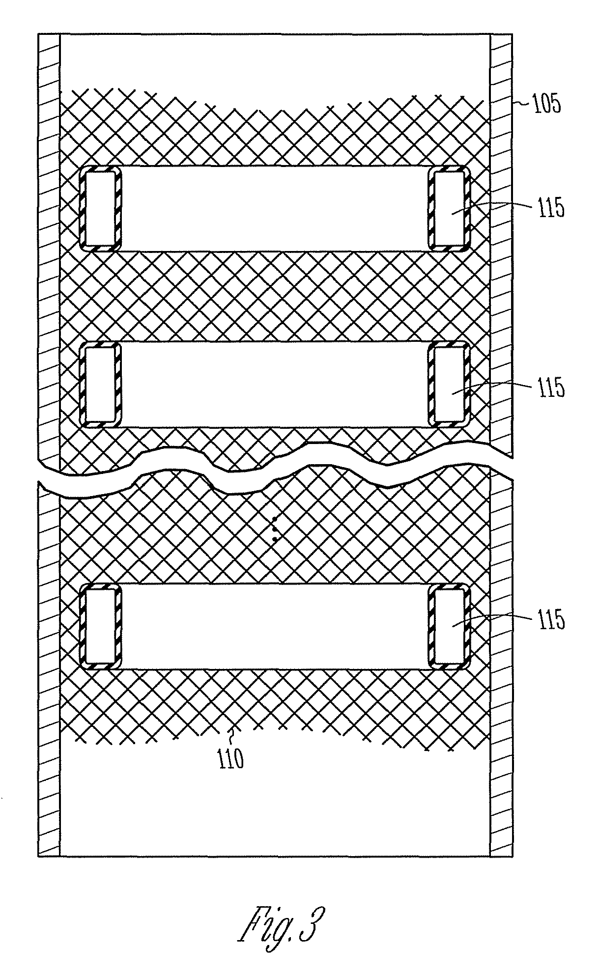 Vascular elastance