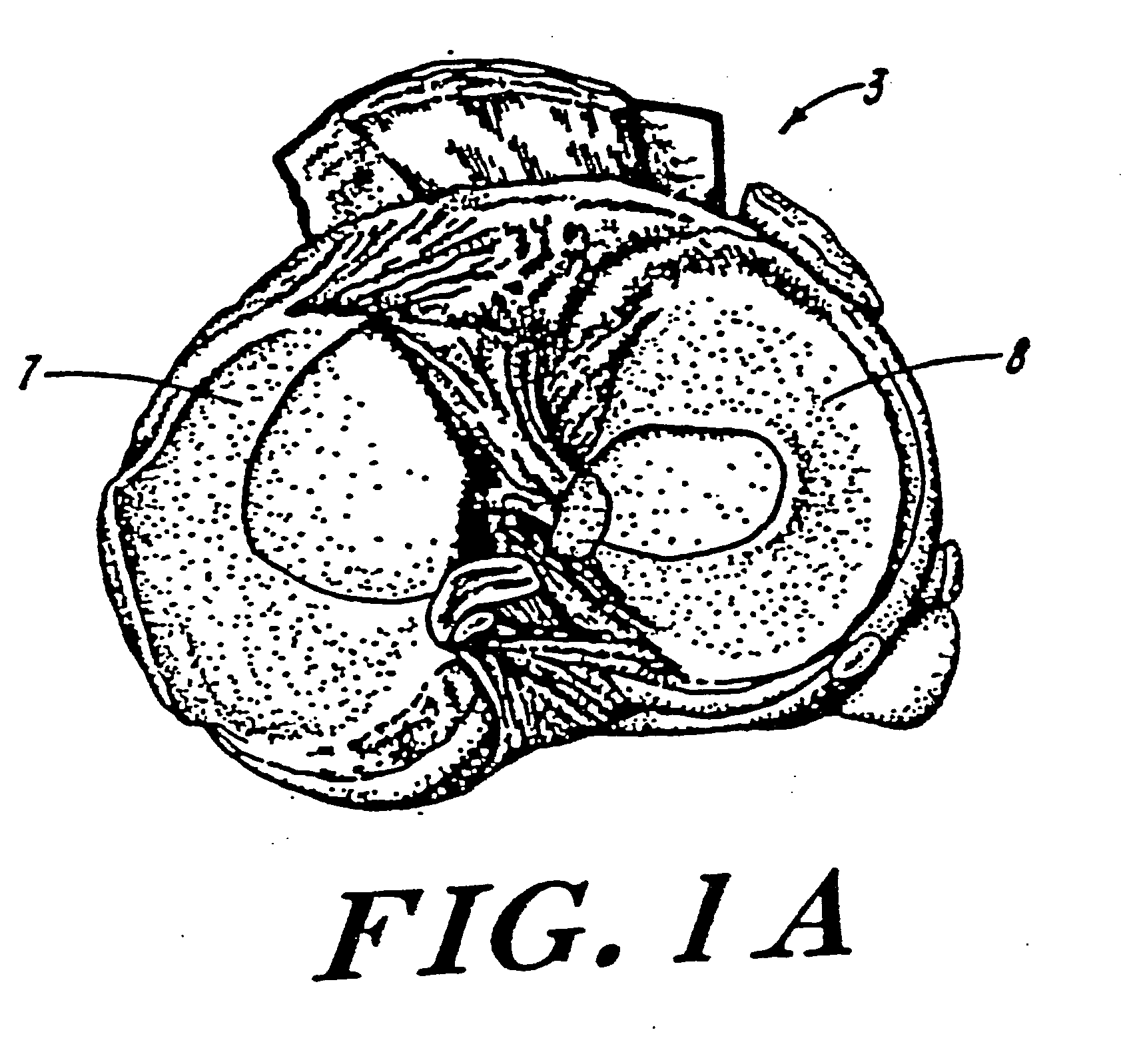 Galactosidase-treated prosthetic devices