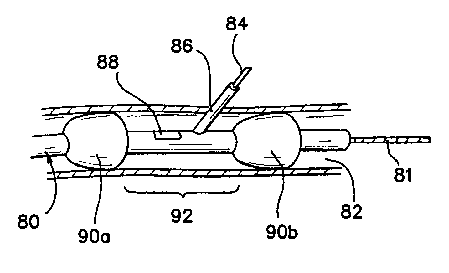 Stabilized tissue penetrating catheters