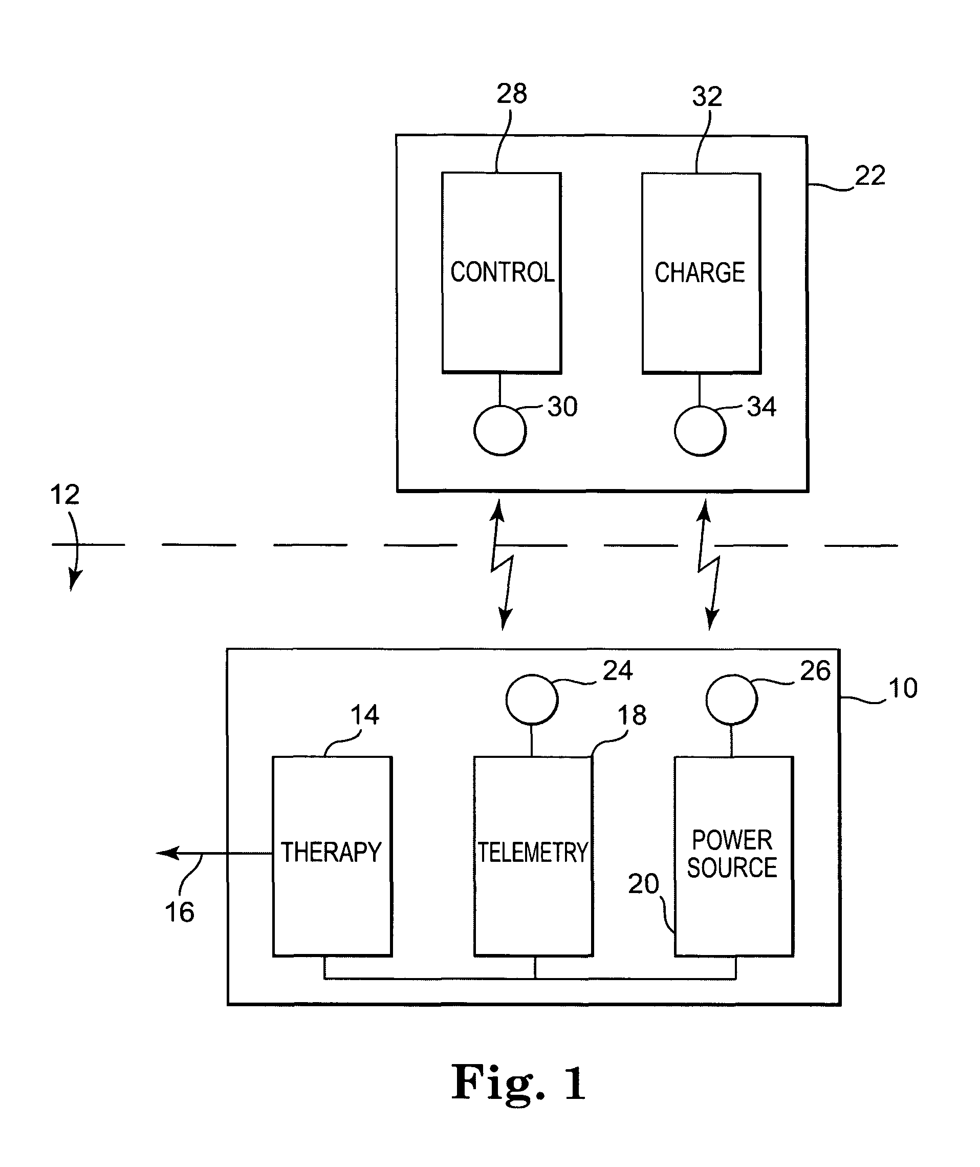 Concurrent delivery of treatment therapy with telemetry in an implantable medical device