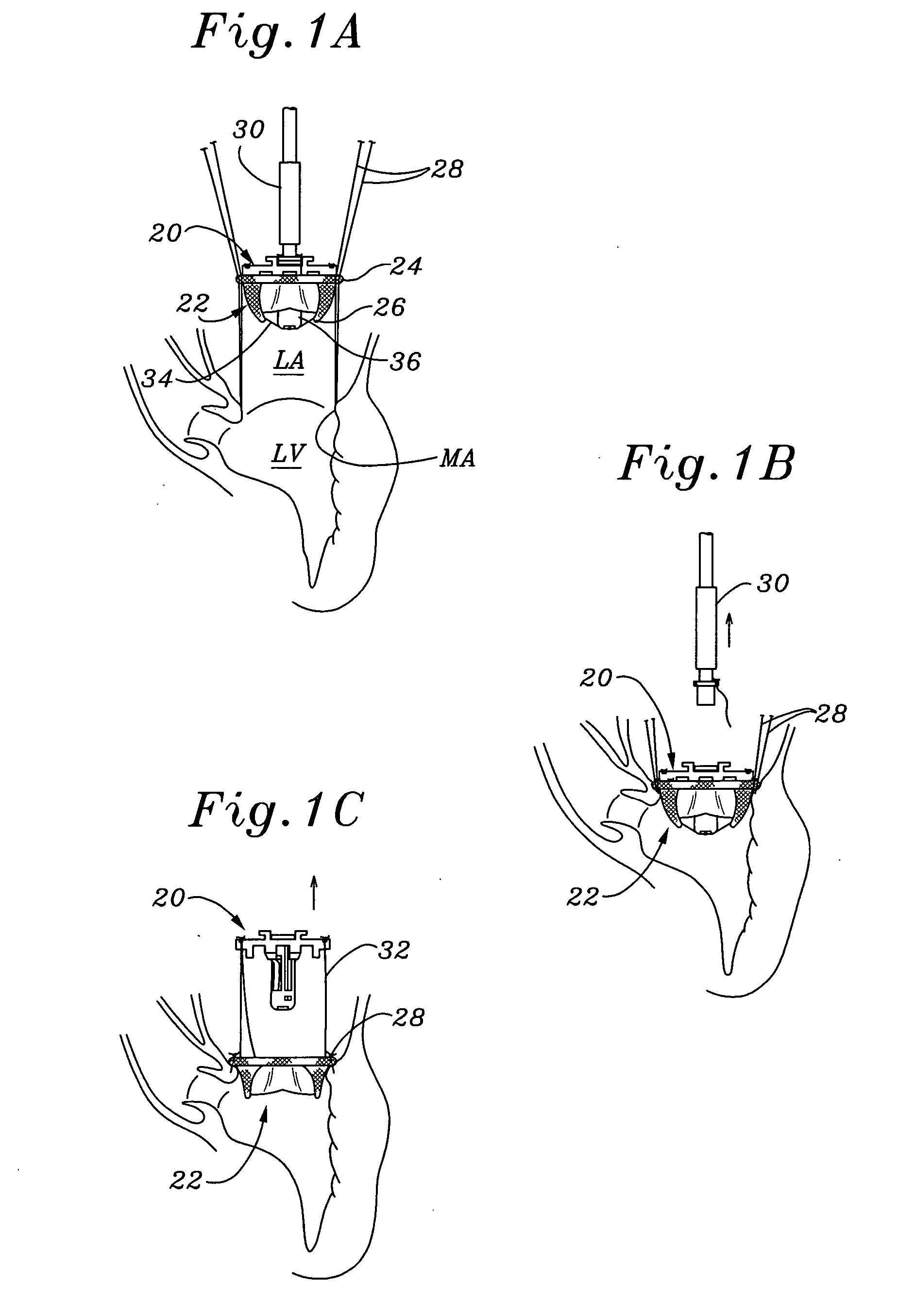 Heart valve holder and method for resisting suture looping