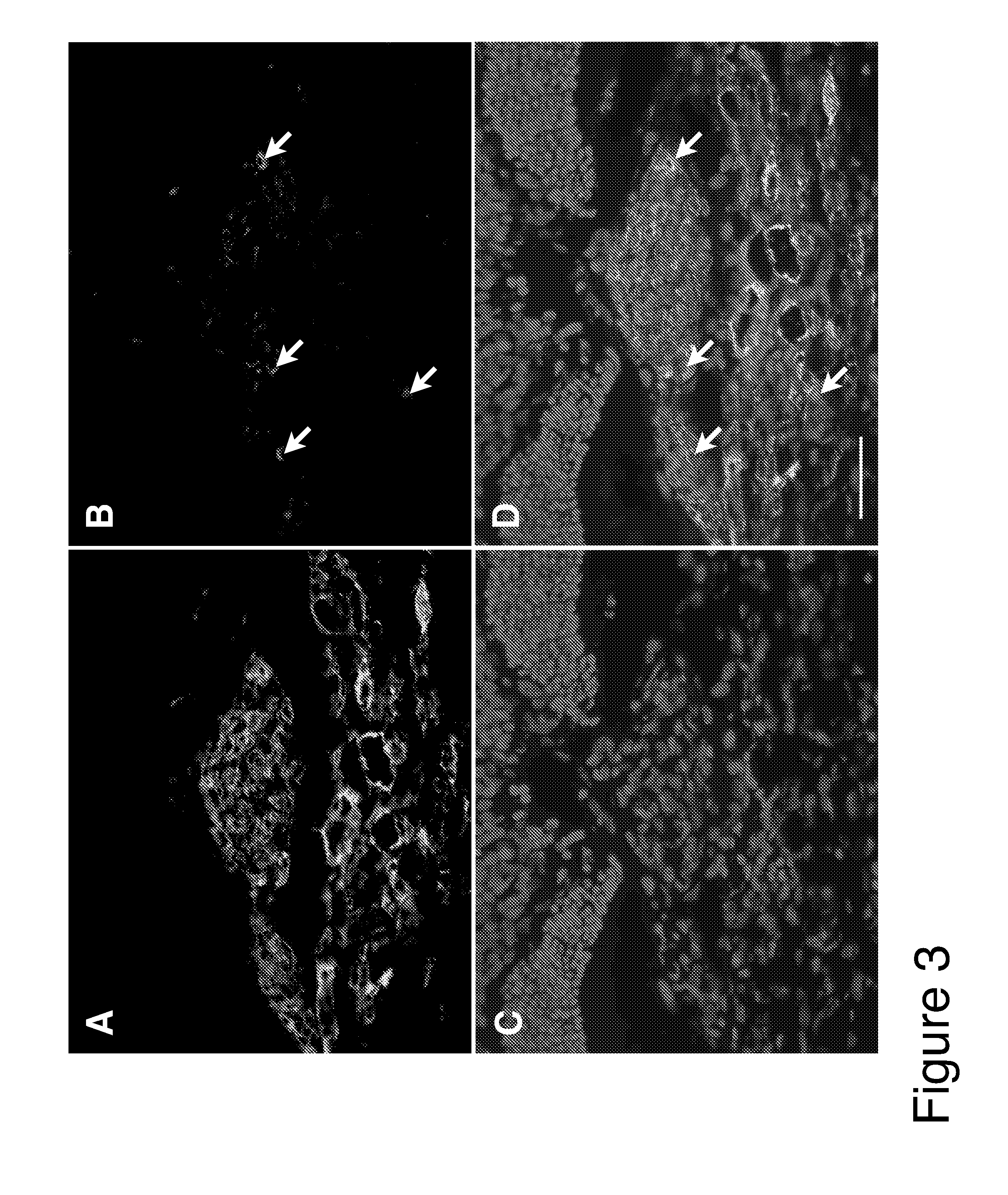 Methods and compositions for treating conditions associated with angiogenesis using a vascular adhesion protein-1 (vap-1) inhibitor