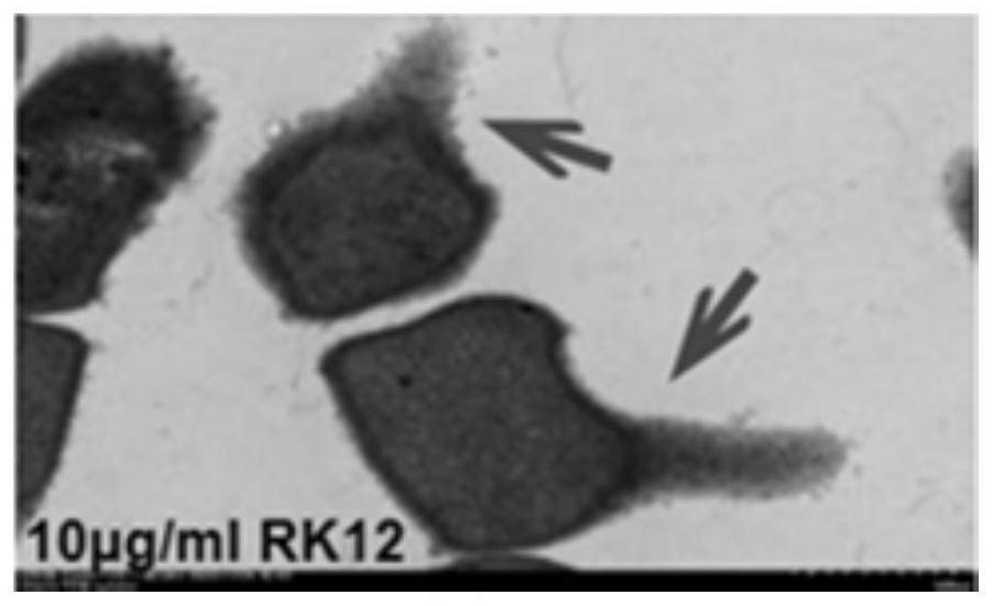 Application of polypeptide RK12 in preparation of medicine for treating acne