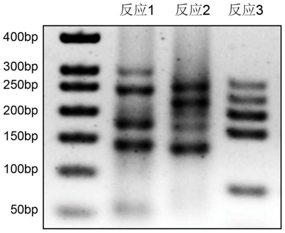 A kit and gene chip for detecting common mutations of atp7b gene