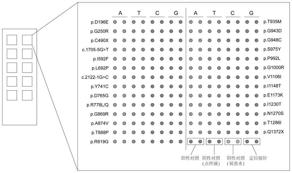 A kit and gene chip for detecting common mutations of atp7b gene