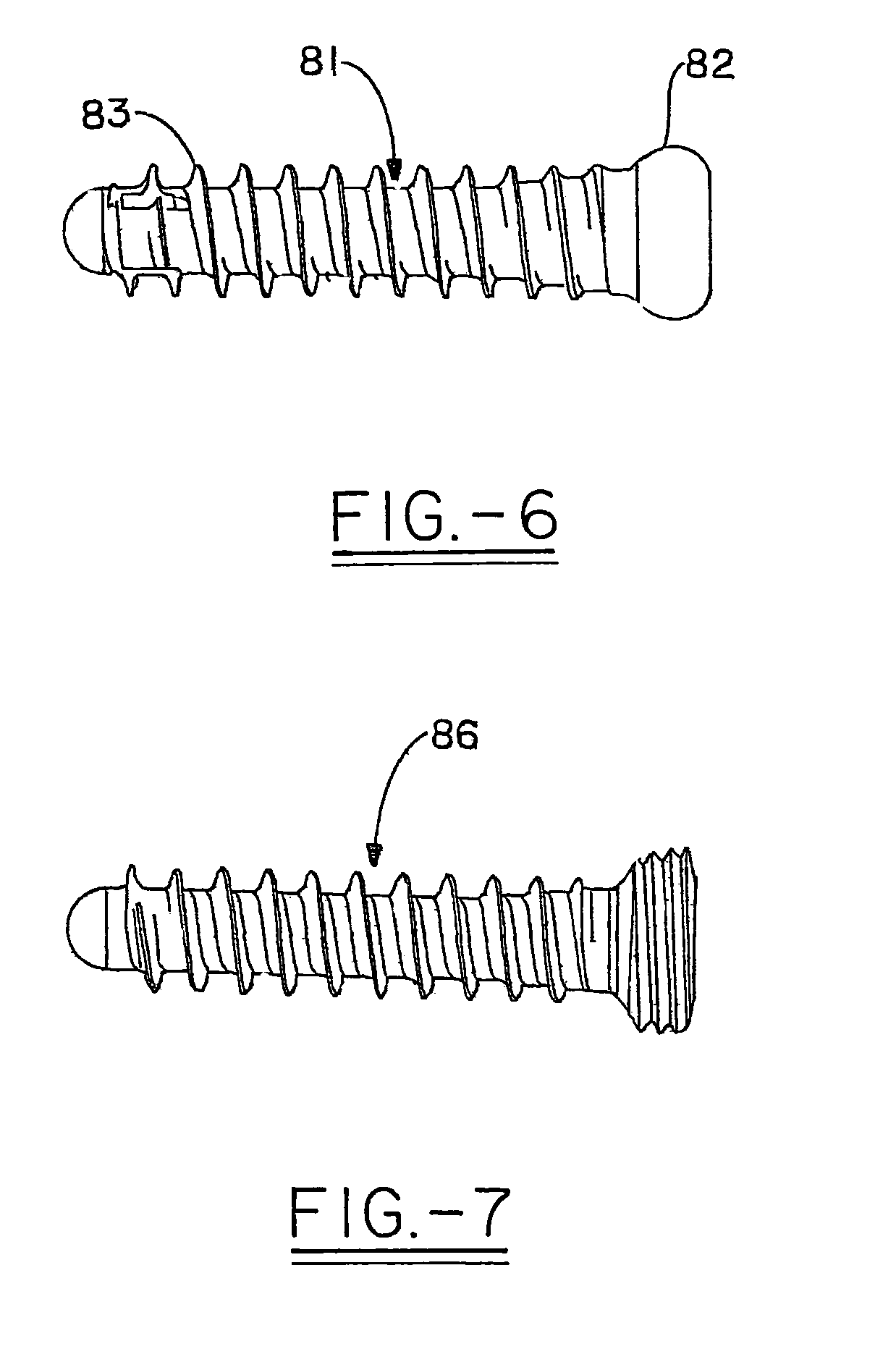 Orthopedic plate for use in fibula repair