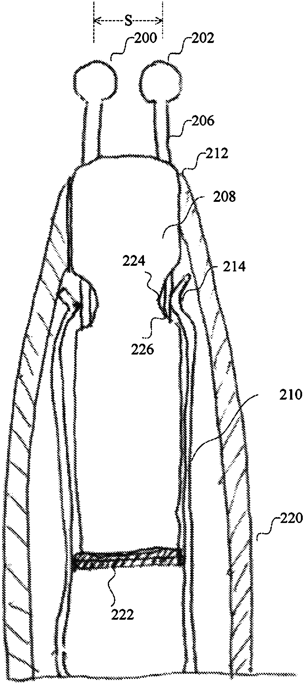 Device for electrical stimulation of peridontal complex and surrounding tissue