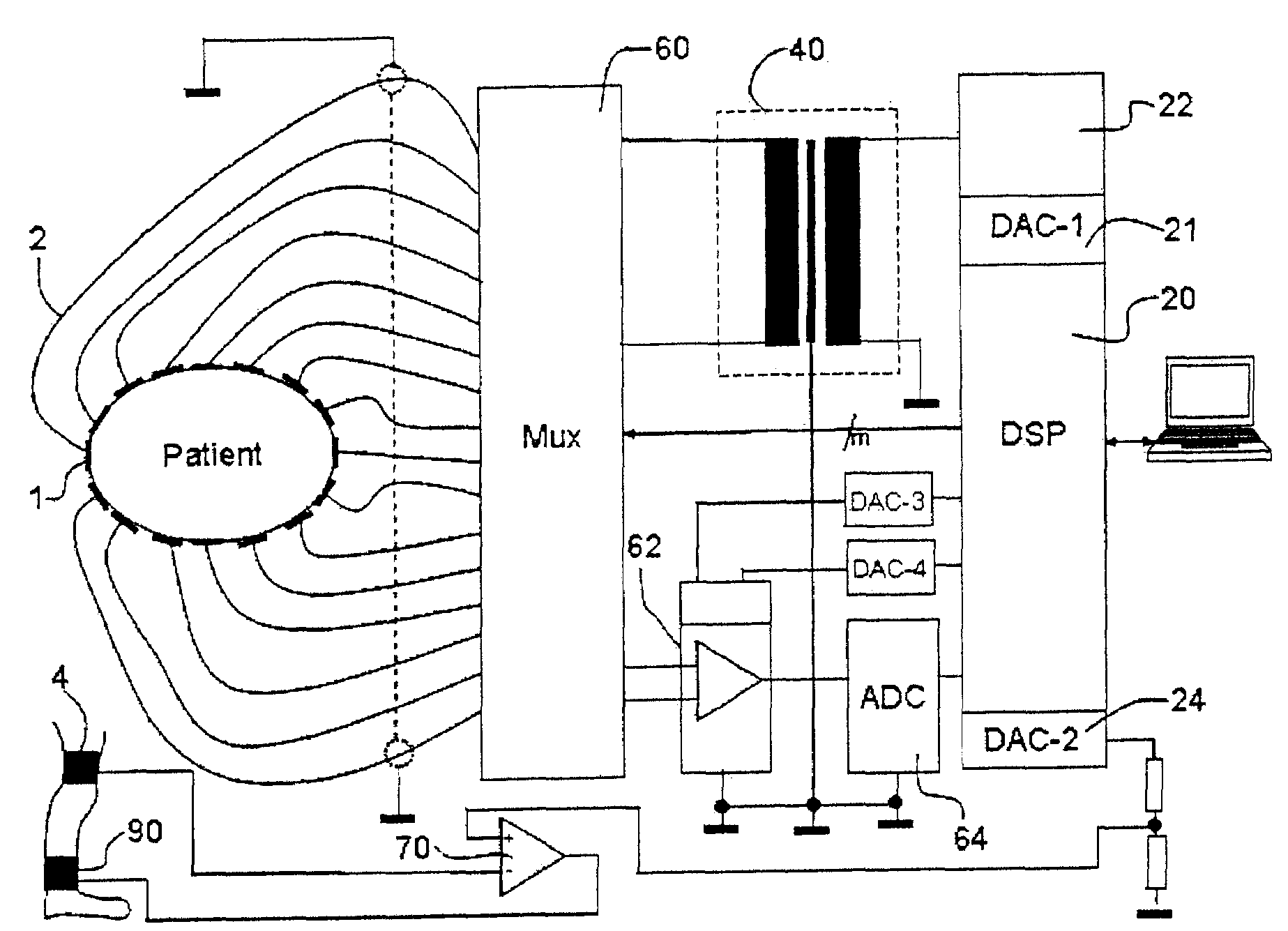 Electroimpedance tomograph with common-mode signal suppression