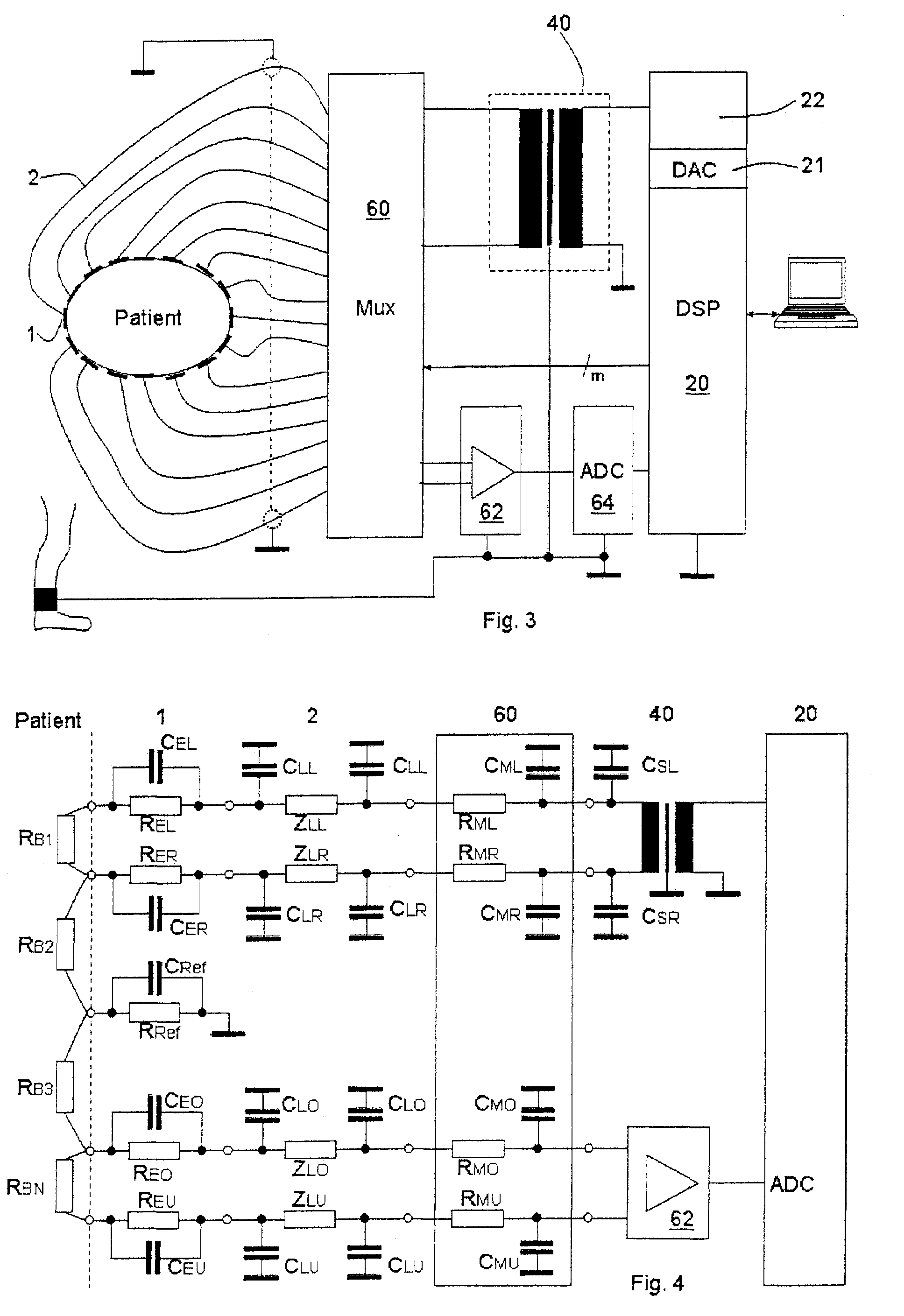 Electroimpedance tomograph with common-mode signal suppression