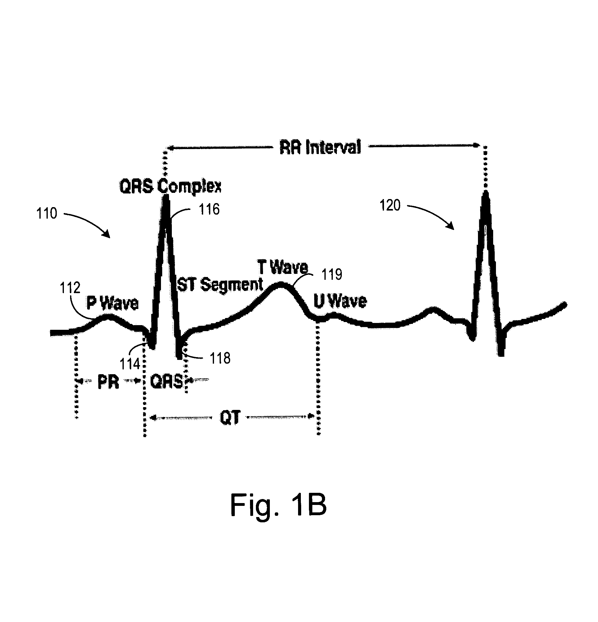 Cardiac activation sequence monitoring and tracking