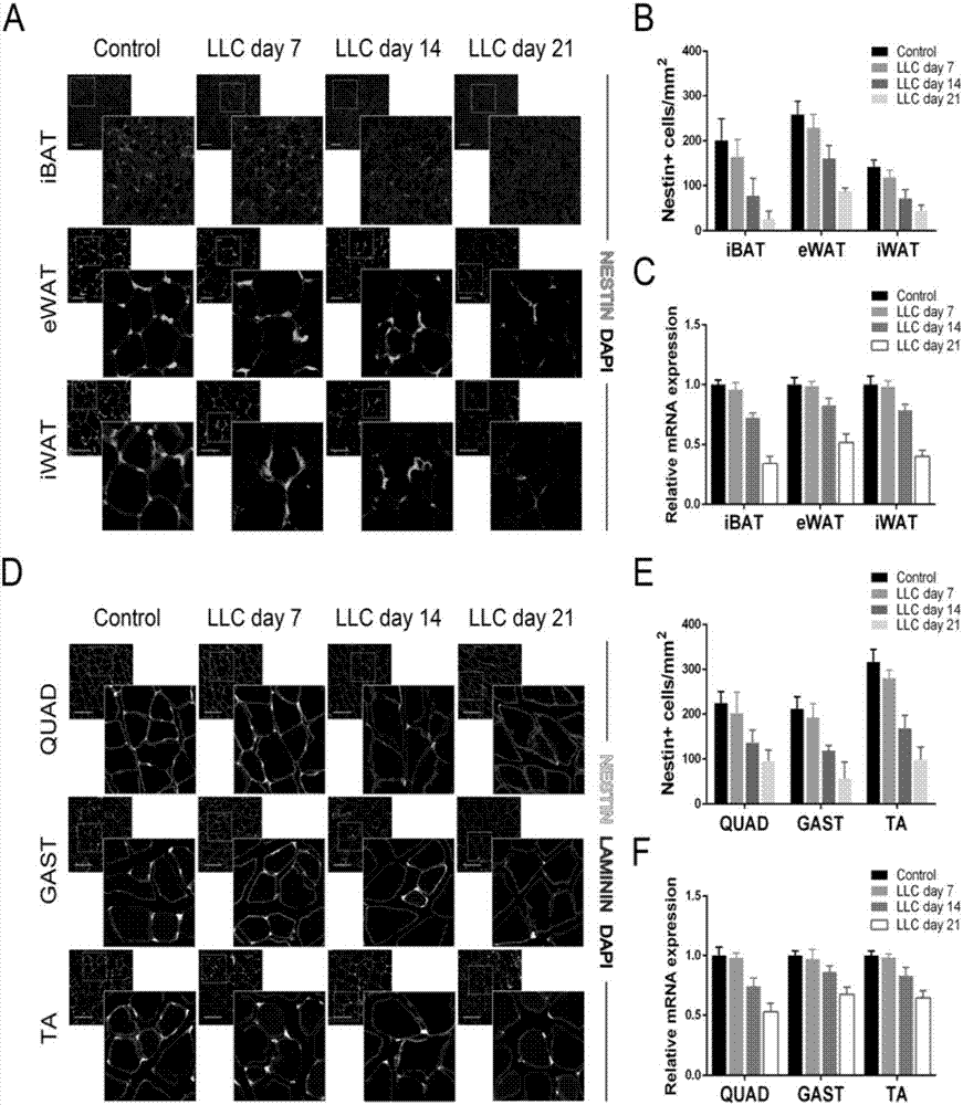 Application of AMD3100 to preparation of medicine for treating and/preventing dyscrasia