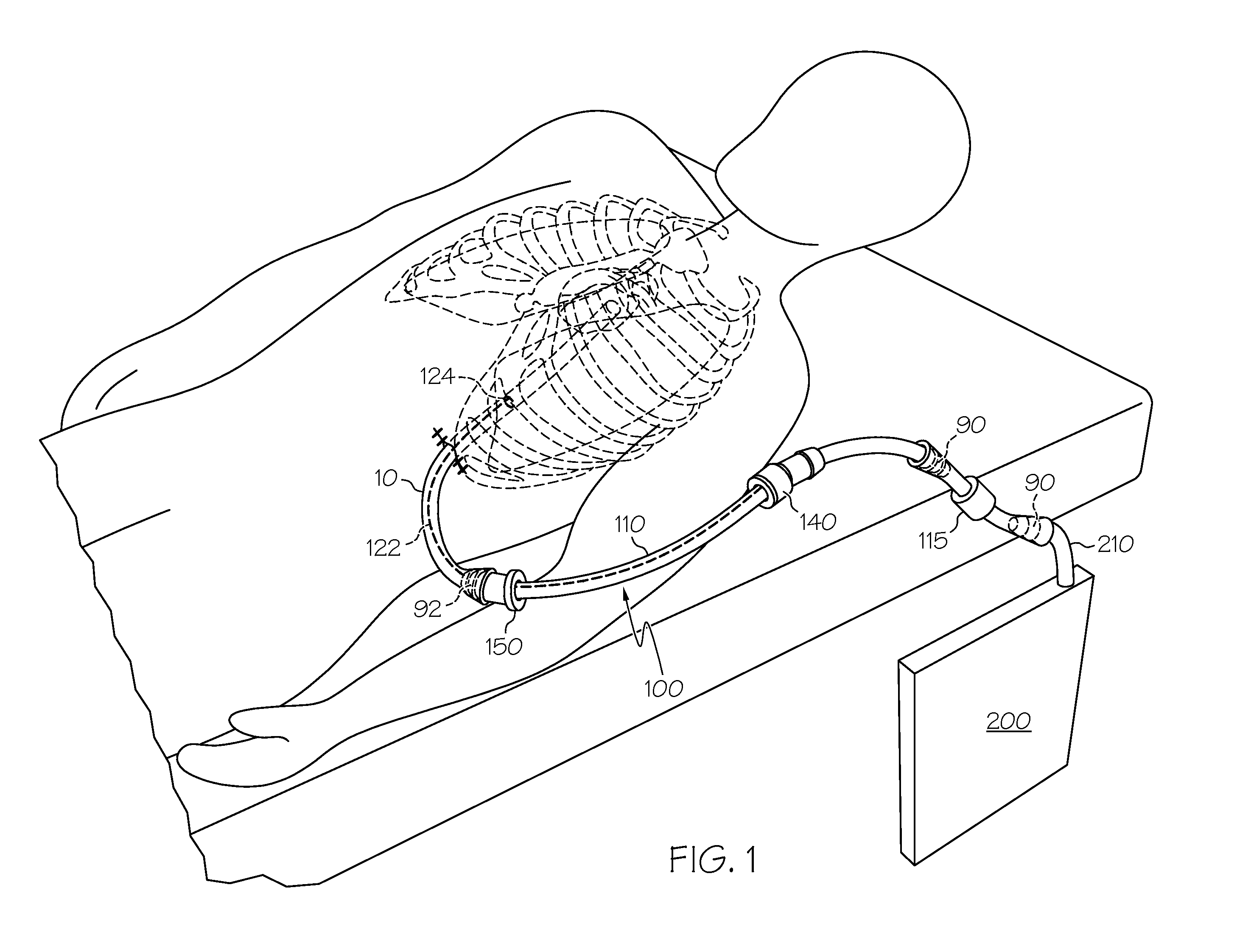 Methods and devices to clear obstructions from medical tubes