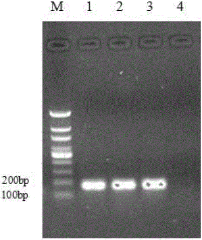 Multiple fluorescence immunoassay method for detecting mycoplasma gallisepticum and mycoplasma synoviae