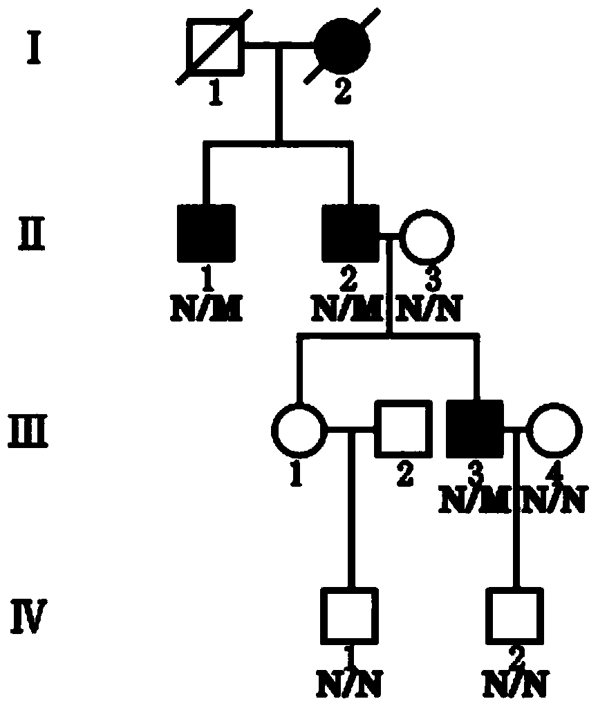 New mutant pathogenic gene of febrile convulsion as well as coding protein and application thereof