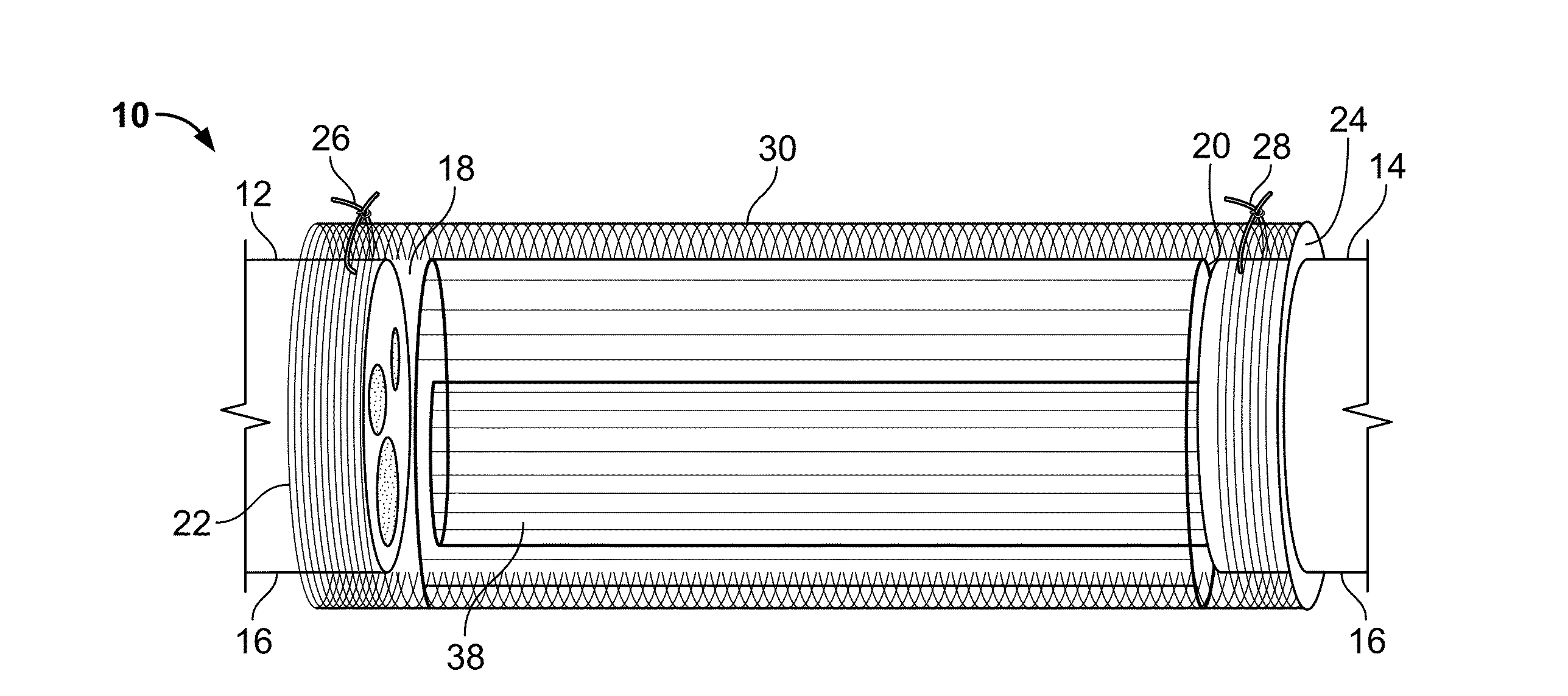 Implantable nerve conduit having a polymer fiber spiral guidance channel