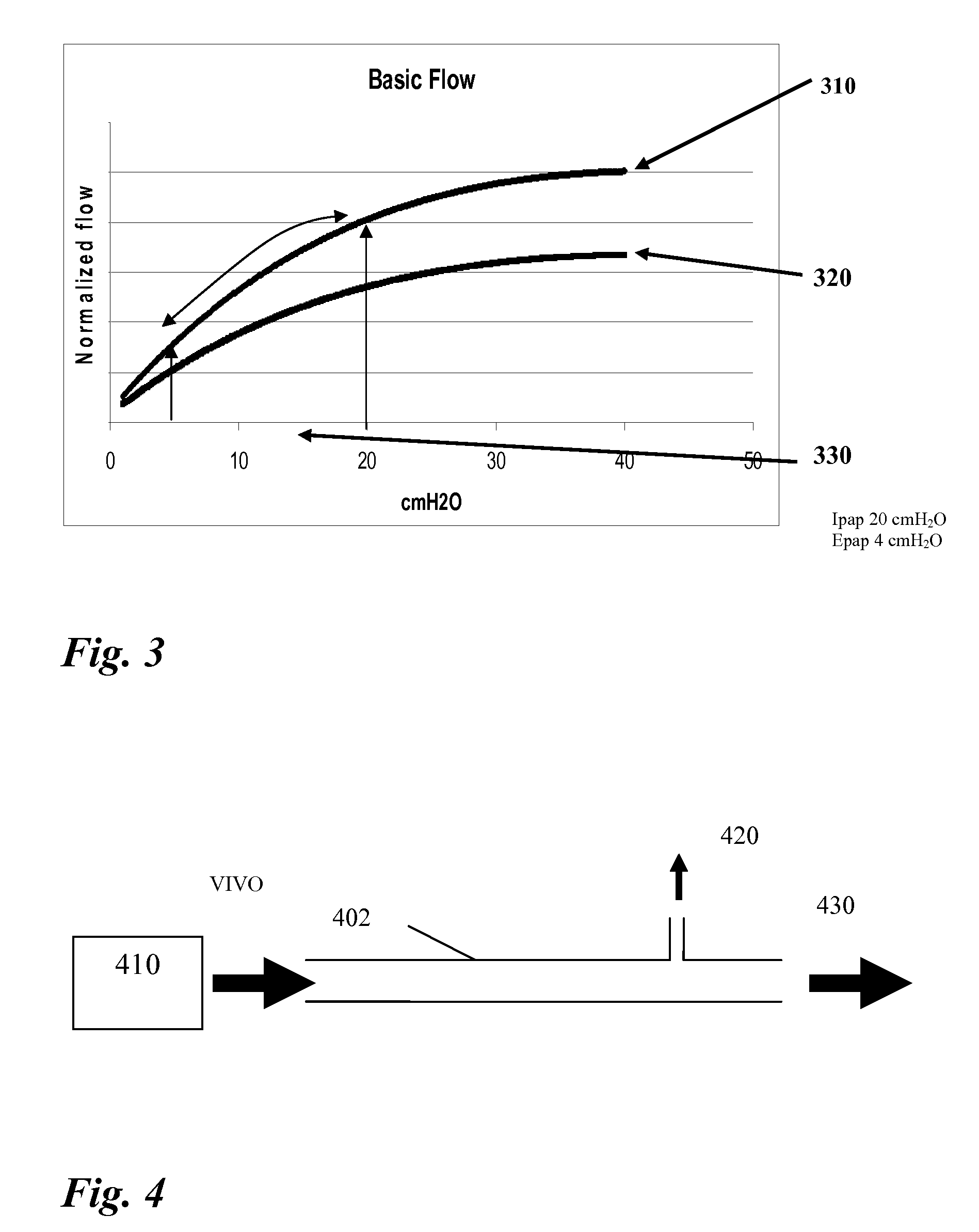 Apparatus, method, system and computer program for leakage compensation for a ventilator