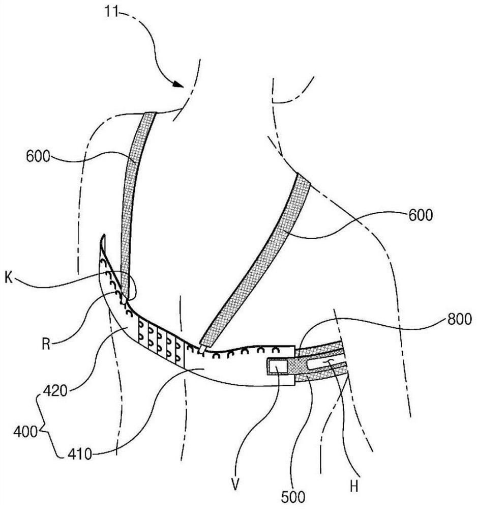 Brassiere for radiation therapy