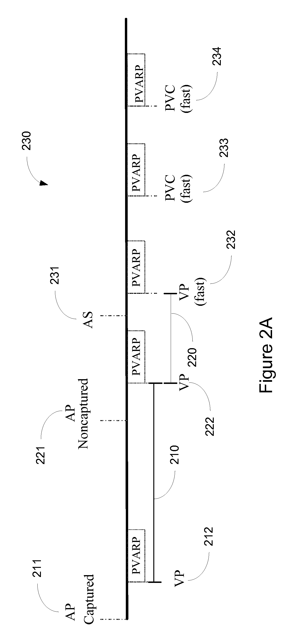 Methods and systems for mitigating the occurrence of arrhythmia during atrial pacing