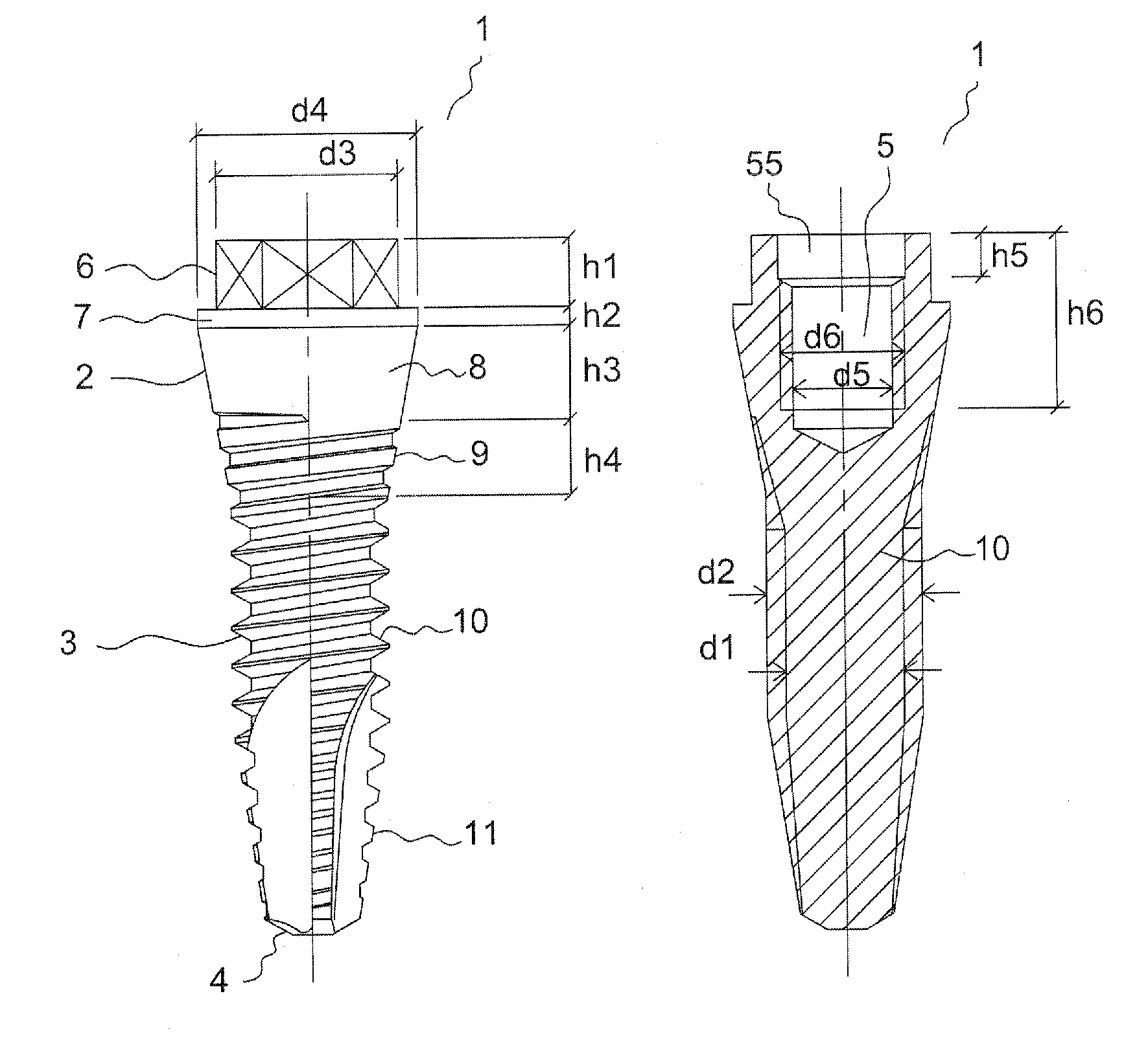 Narrow Dental Implant and Associated Parts