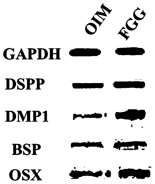 New application of fibrinogen gamma chain in field of tooth regeneration and kit