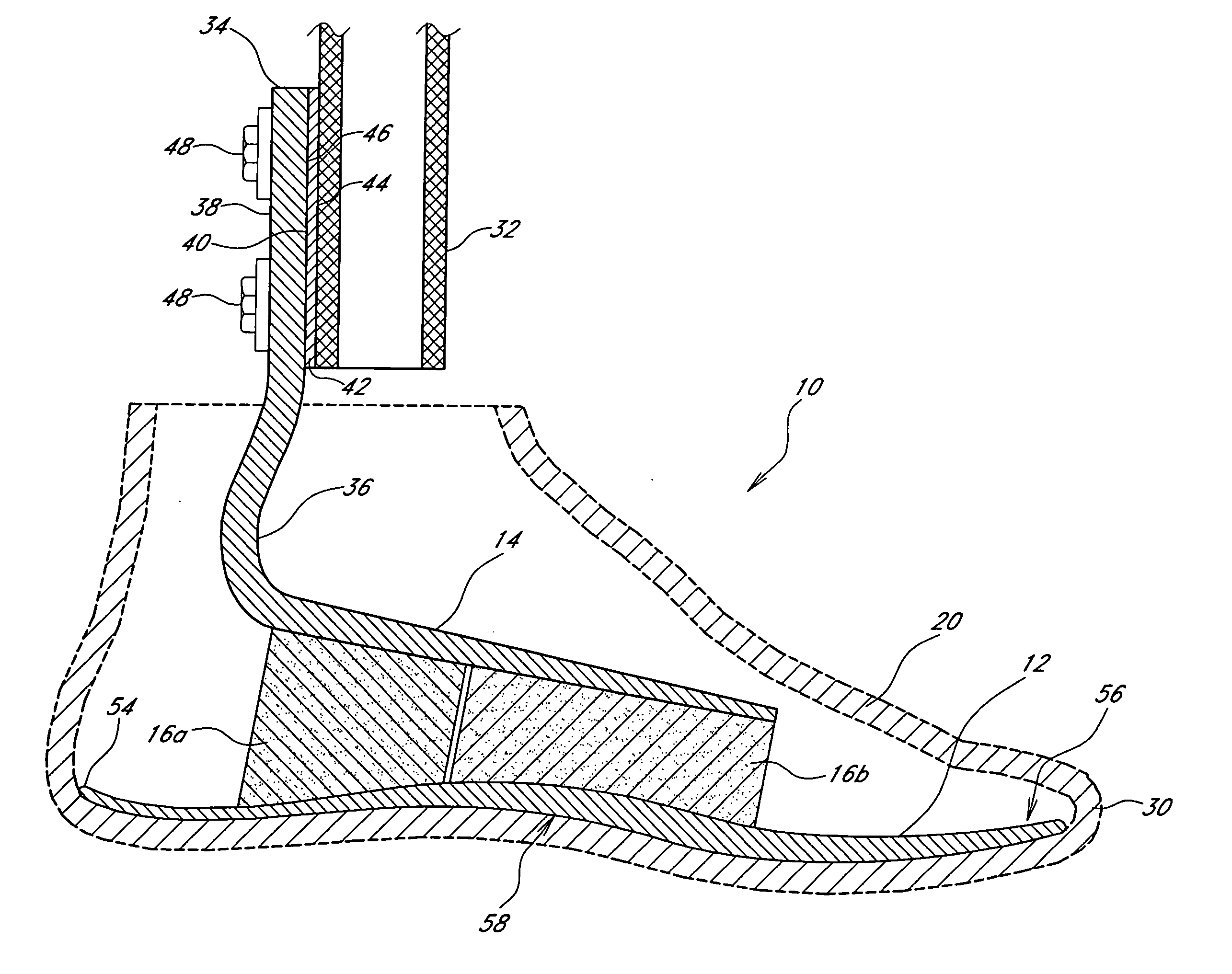 Foot prosthesis having cushioned ankle