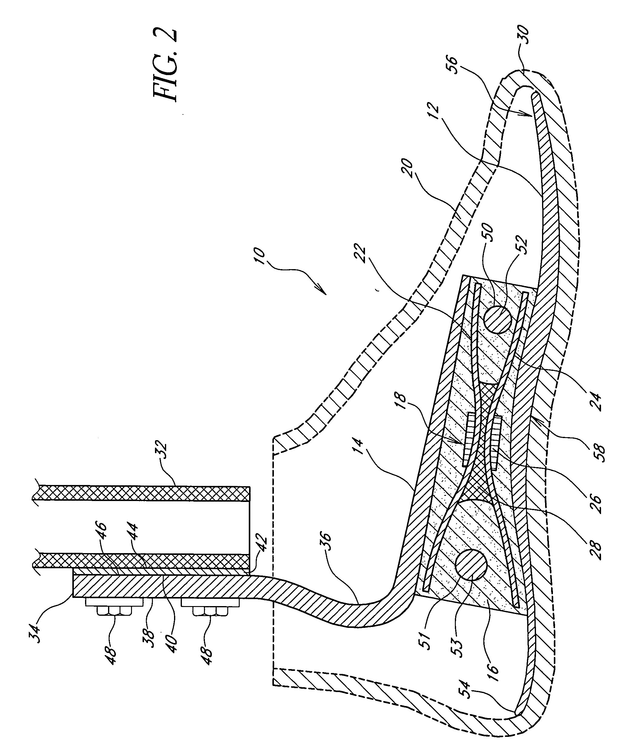 Foot prosthesis having cushioned ankle