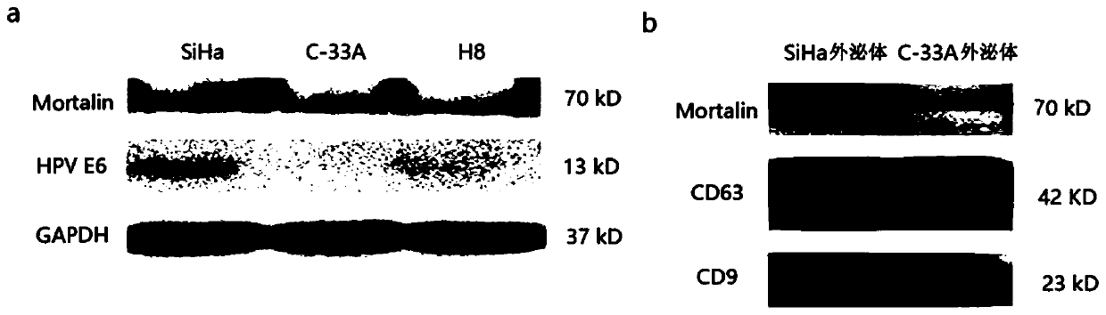 Early diagnosis marker for cervical cancer caused by HPV infection based on plasma exosome protein and application of early diagnosis marker