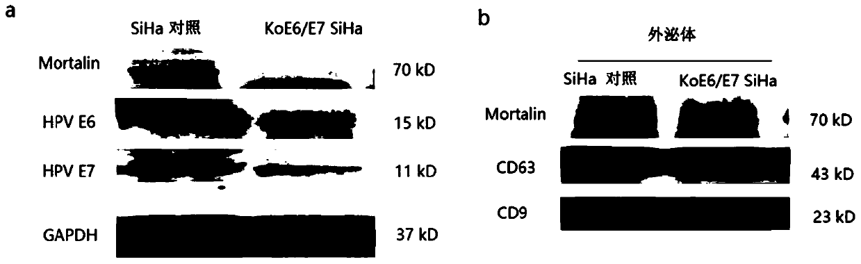 Early diagnosis marker for cervical cancer caused by HPV infection based on plasma exosome protein and application of early diagnosis marker