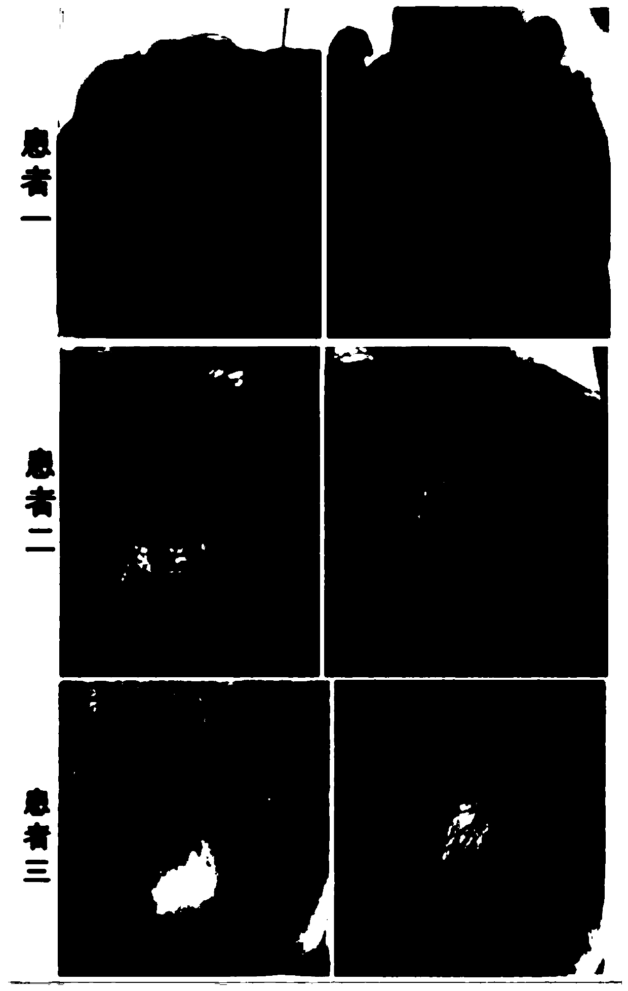 Preparation and application of exosome with efficacy of hair growth promoting