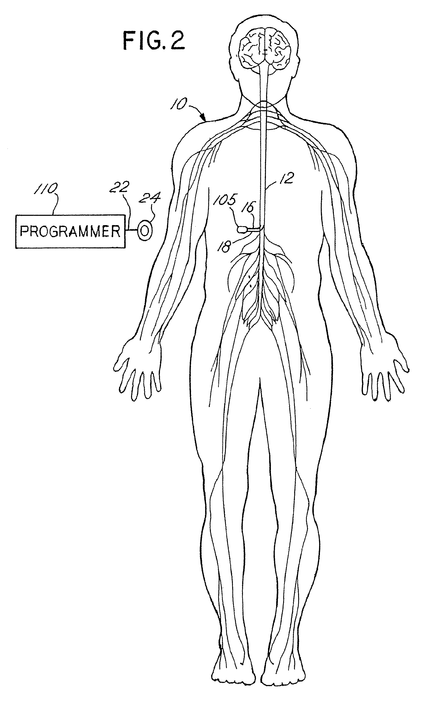 Non-conformance monitoring and control techniques for an implantable medical device