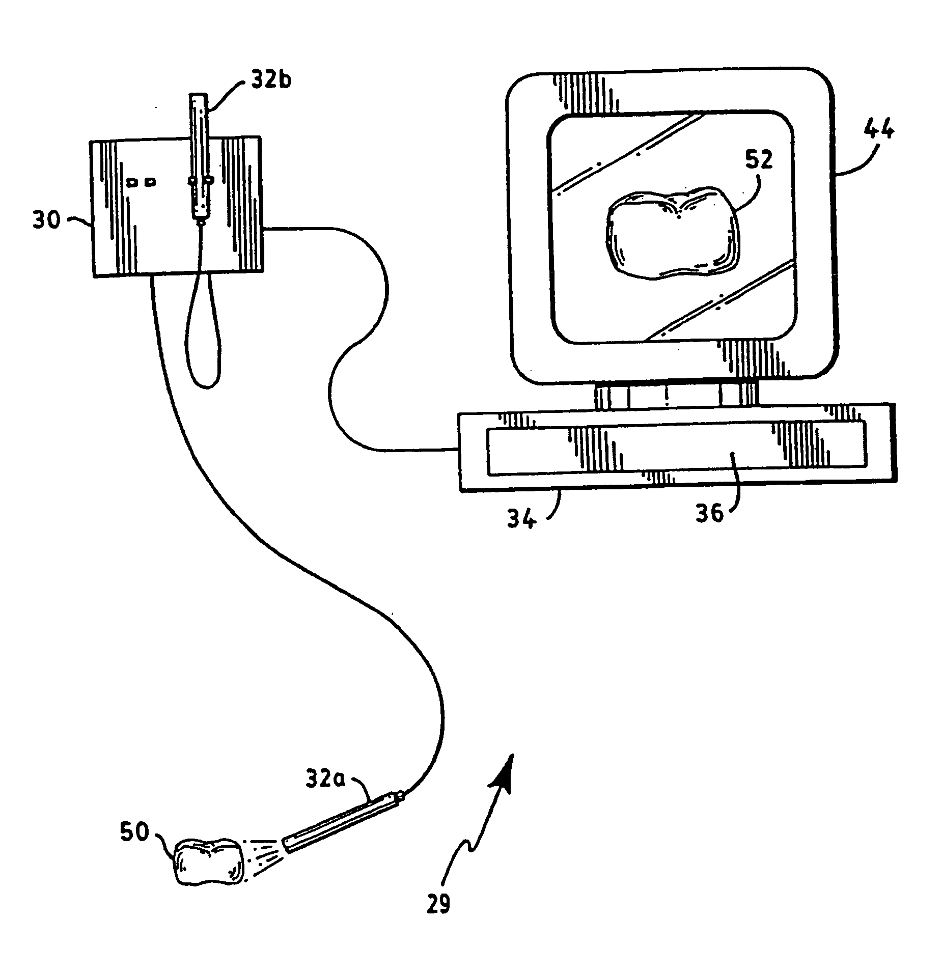 Tooth shade analyzer system and methods