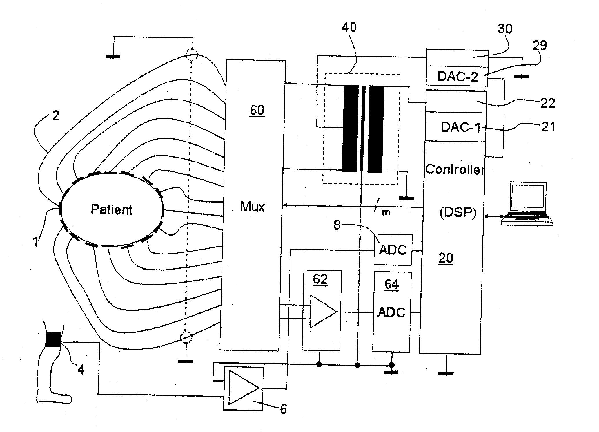 Electroimpedance tomograph with common-mode signal suppression