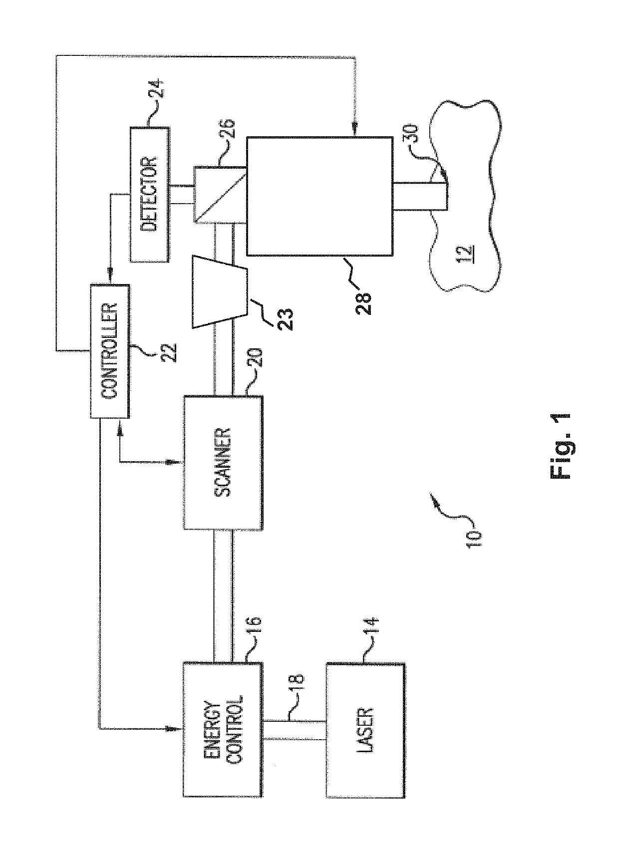 Systems and methods for synchronized three-dimensional laser incisions