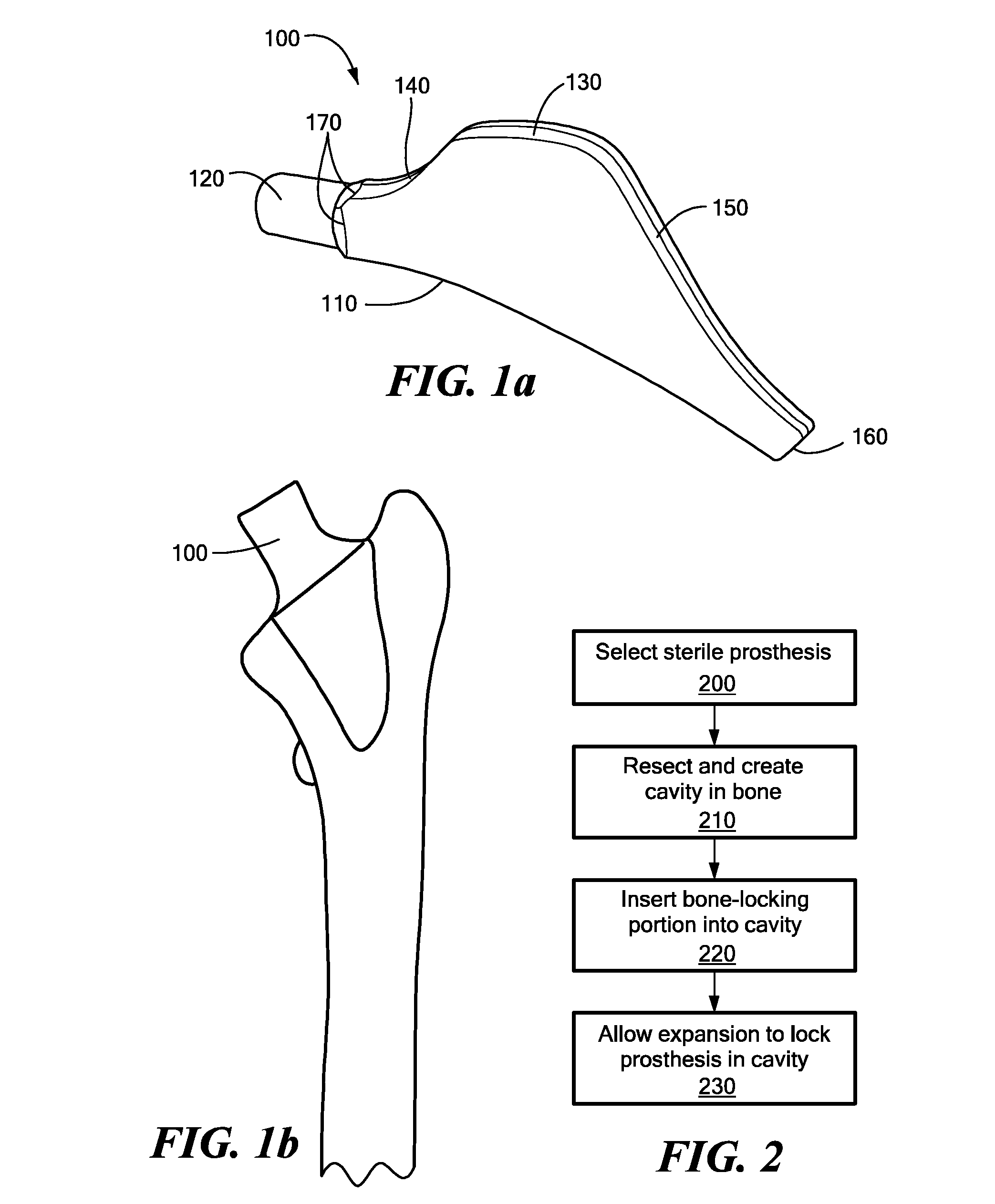 Proximally Self-Locking Long Bone Prosthesis