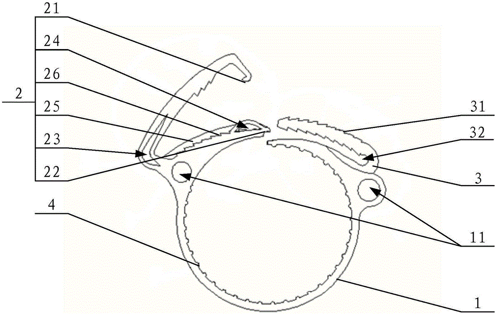 Anastomosis fastening ring for main arteries and artificial blood vessel assembly with anastomosis fastening ring