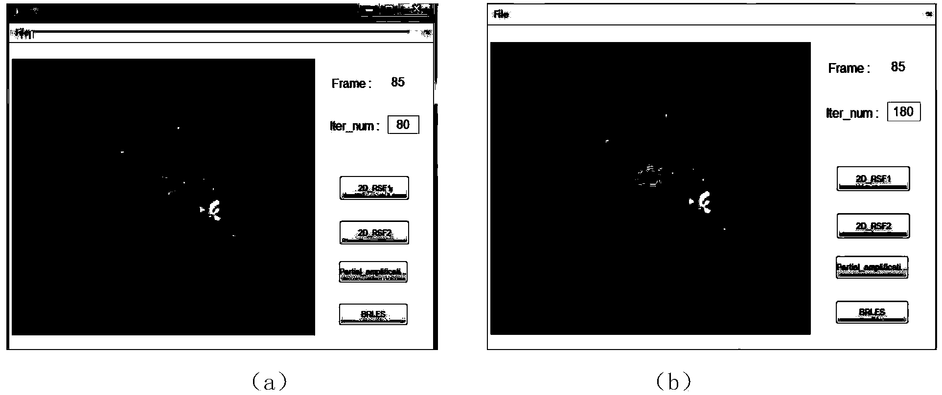 Breast tumor partition method based on nuclear magnetic resonance images