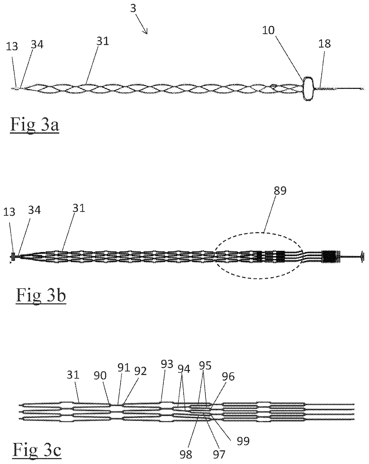 A clot retrieval device for removing occlusive clot from a blood vessel