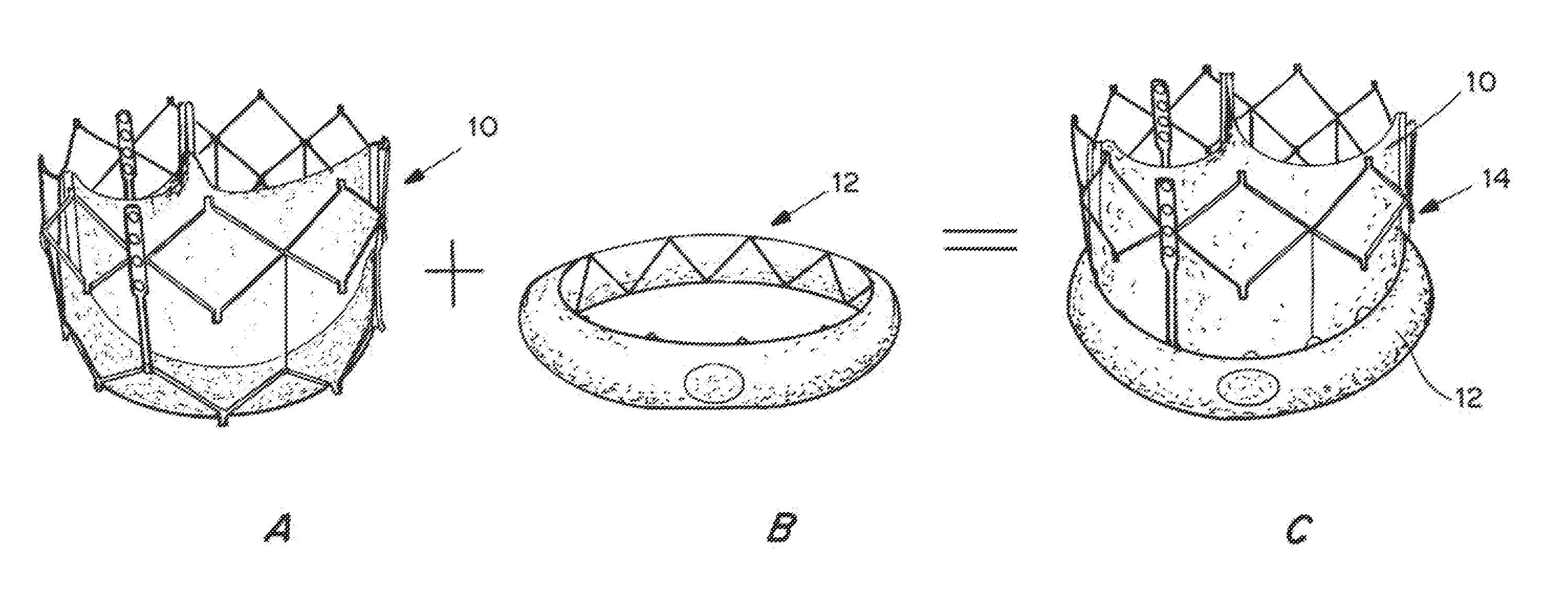 Means for Controlled Sealing of Endovascular Devices