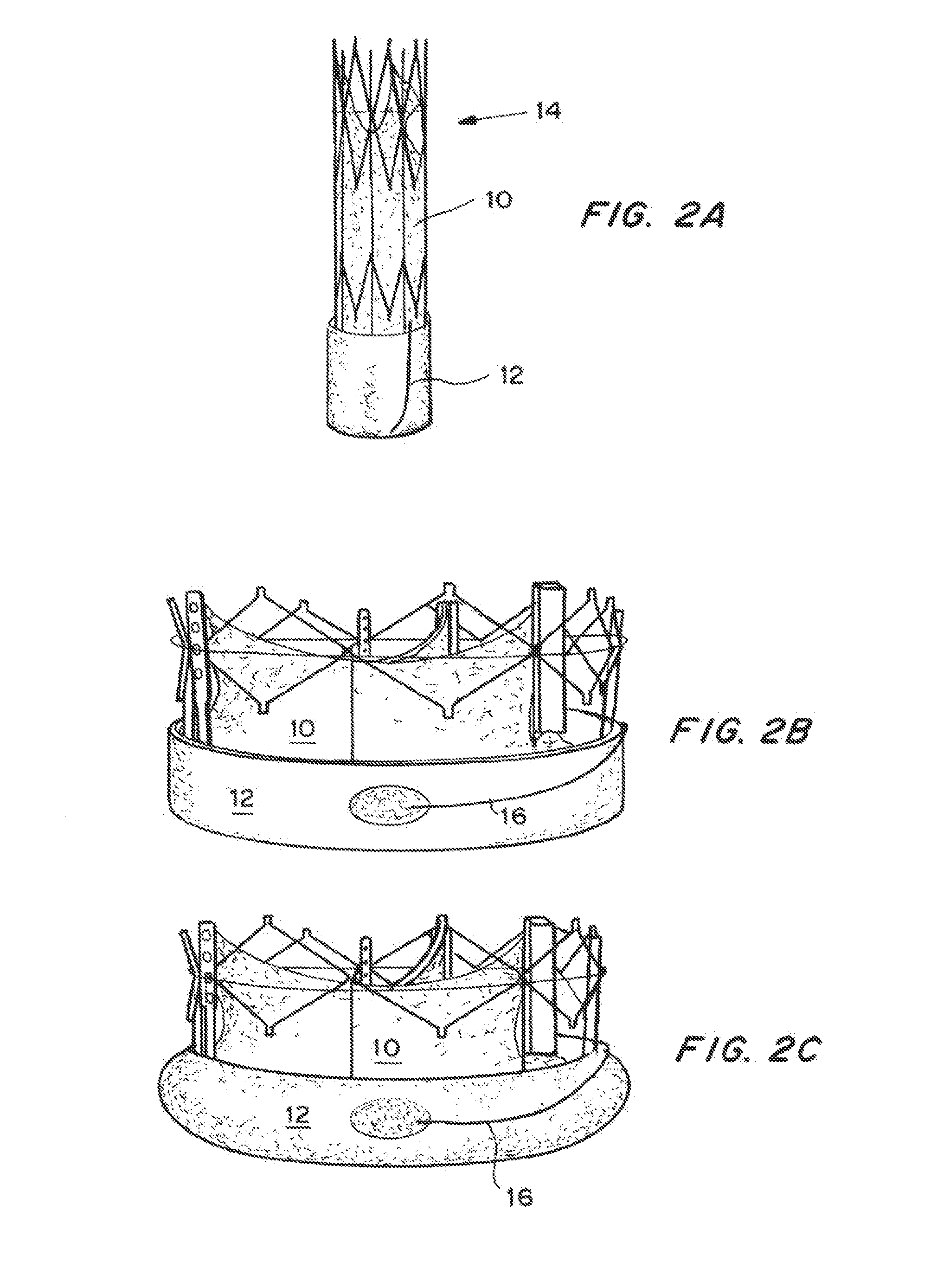 Means for Controlled Sealing of Endovascular Devices