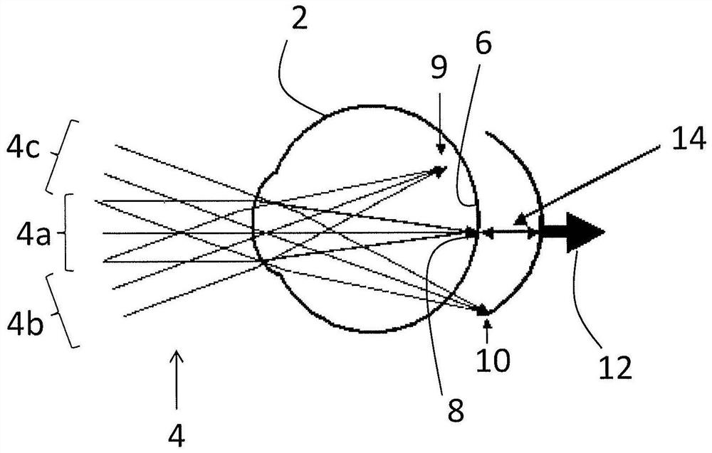 Technique for determining a risk indicator for myopia