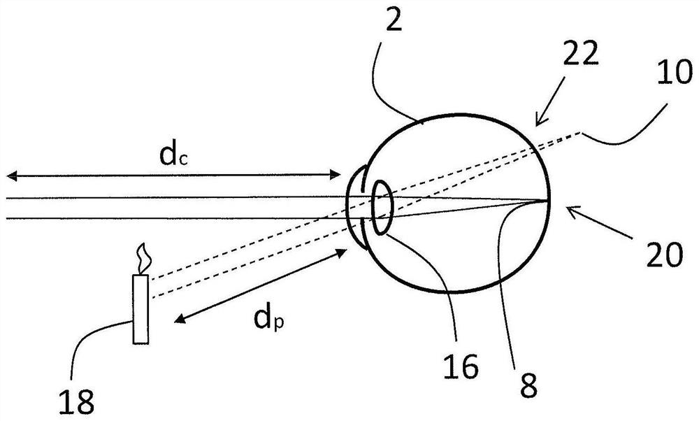 Technique for determining a risk indicator for myopia