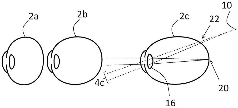 Technique for determining a risk indicator for myopia