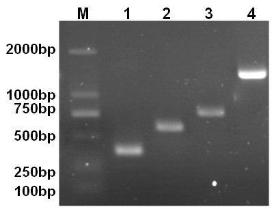 One-step PCR detection of avian leukosis virus a/b/j/k subgroup primer set and kit