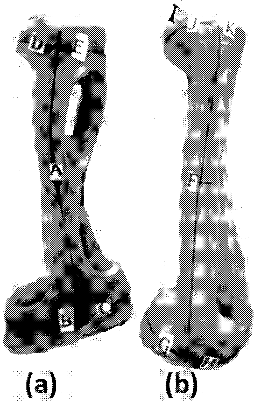 Apparatus and method for treating male impotence