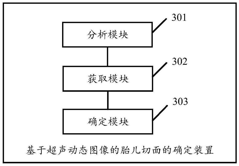 Fetal section determination method and device based on ultrasonic dynamic image