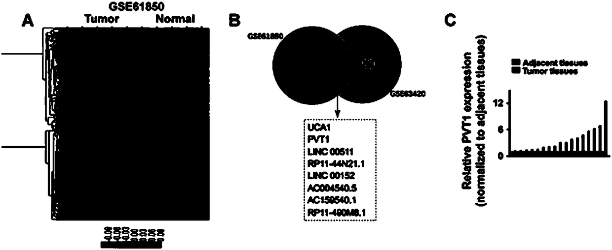 Application of long-chain non-coding RNA and composition thereof to diagnosis and treatment of cancer of biliary duct