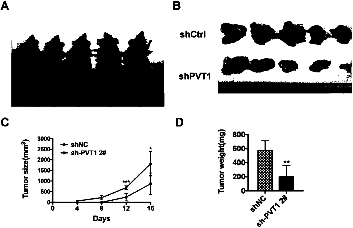 Application of long-chain non-coding RNA and composition thereof to diagnosis and treatment of cancer of biliary duct