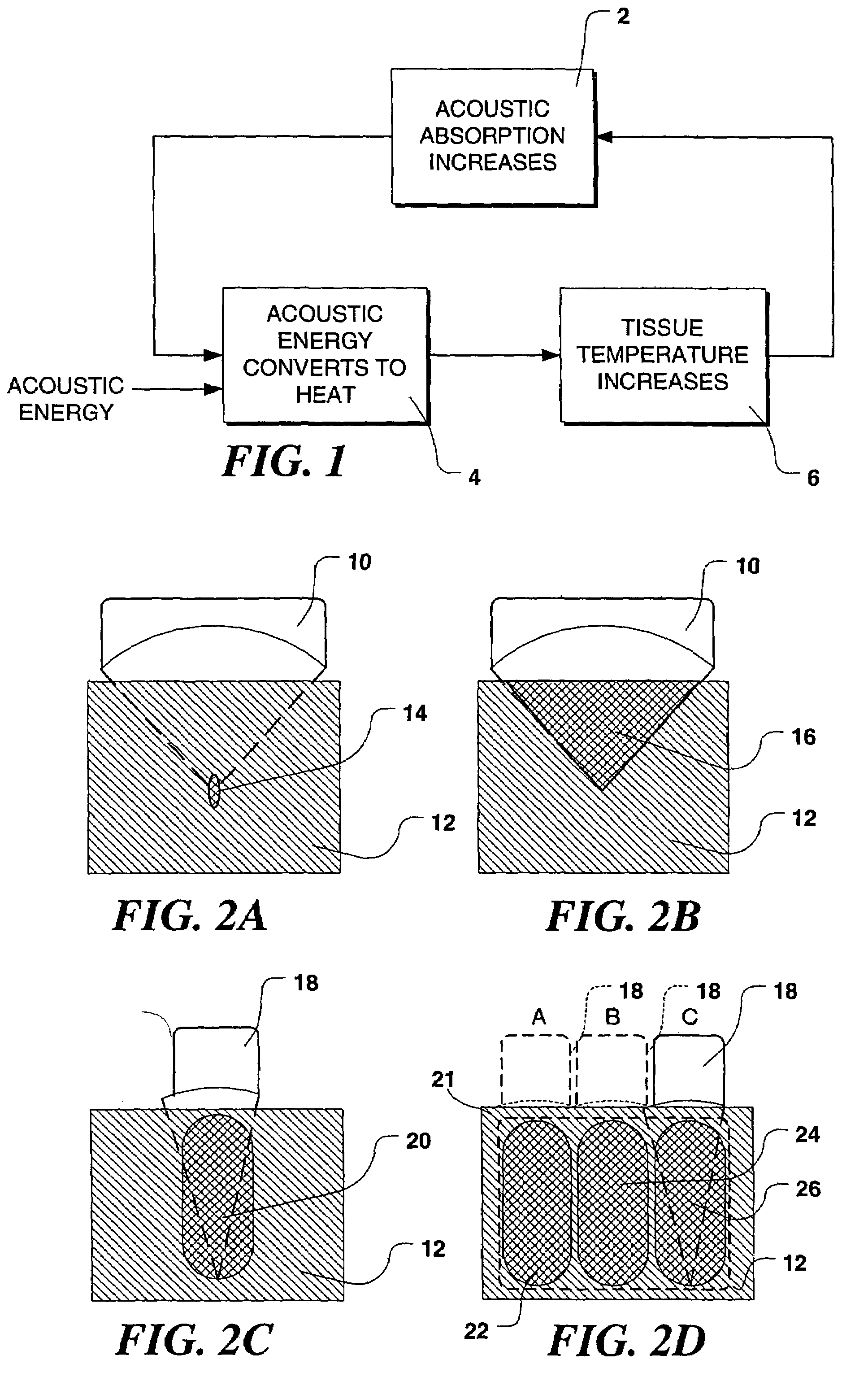 Controlled high efficiency lesion formation using high intensity ultrasound